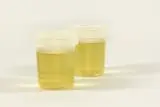 Orina específico