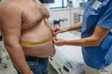 Obesidad